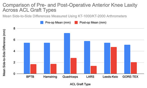 A clustered vertical bar chart shows blue pre-operative and red post-operative side-to-side knee laxity in millimeters for six graft types: BPTB, Hamstring, Quadriceps, LARS, Leeds-Keio, and GORE-TEX.
Each graft type has two adjacent bars – one for pre-op (blue), one for post-op (red) values.
Pre-operative bars are all high, between about 5 and 7 mm, indicating significant instability before surgery.
Post-operative bars are shorter: BPTB ≈ 1.7 mm, Hamstring ≈ 1.75 mm, Quadriceps ≈ 2.8 mm, LARS ≈ 1.4 mm, Leeds-Keio ≈ 4.75 mm, and GORE-TEX ≈ 2.05 mm.
The visual contrast shows large reductions in laxity for most grafts, with Leeds-Keio remaining visibly higher than the others.
