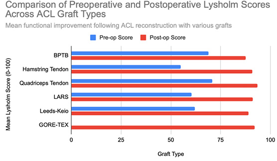 A horizontal bar chart is titled “Comparison of Preoperative and Postoperative Lysholm Scores Across ACL Graft Types”.
The vertical axis lists six graft types from top to bottom: BPTB, Hamstring Tendon, Quadriceps Tendon, LARS, Leeds-Keio, and GORE-TEX.
The horizontal axis shows Lysholm scores from 0 to 100.
Each graft type has two horizontal bars: a blue bar for the pre-operative score and a red bar for the post-operative score.
Blue bars are shorter for all grafts, ranging roughly from 55 to 71.
Red bars extend further right, between 87 and 93 points.
The GORE-TEX graft has only one red bar (with no blue pre-operative bar shown).
All grafts display visibly longer red bars, illustrating functional improvement after reconstruction.

