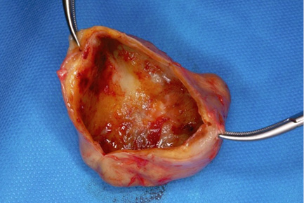 A piece of meat with a hook in it.
Description generated by AI