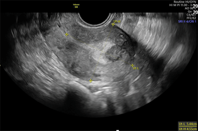A black and white image of a pregnant woman.
Description generated by AI