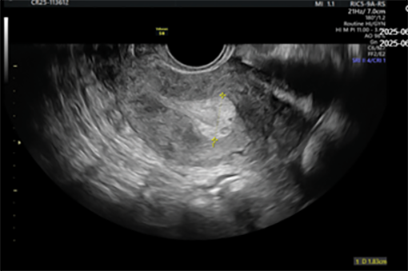 A black and white image of a pregnant woman.
Description generated by AI